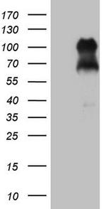 FOXO3 Antibody in Western Blot (WB)