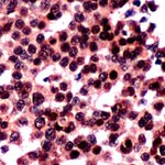 FOXO3A Antibody in Immunohistochemistry (IHC)