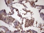 FOXO4 Antibody in Immunohistochemistry (Paraffin) (IHC (P))