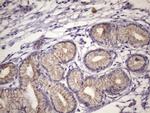 FOXO4 Antibody in Immunohistochemistry (Paraffin) (IHC (P))