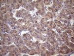 FOXO4 Antibody in Immunohistochemistry (Paraffin) (IHC (P))