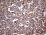 FOXO4 Antibody in Immunohistochemistry (Paraffin) (IHC (P))