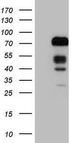 FOXO4 Antibody in Western Blot (WB)