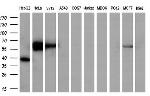 FOXO4 Antibody in Western Blot (WB)