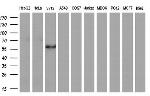 FOXO4 Antibody in Western Blot (WB)