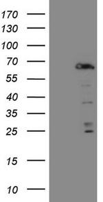 FOXO4 Antibody in Western Blot (WB)