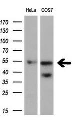 FOXO4 Antibody in Western Blot (WB)