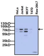 FOXP1 Monoclonal Antibody (6E4C4)