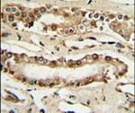 FOXP1 Antibody in Immunohistochemistry (IHC)