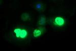 FOXP1 Antibody in Immunocytochemistry (ICC/IF)