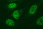 FOXP1 Antibody in Immunocytochemistry (ICC/IF)
