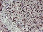 FOXP1 Antibody in Immunohistochemistry (Paraffin) (IHC (P))
