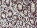 FOXP1 Antibody in Immunohistochemistry (Paraffin) (IHC (P))