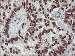 FOXP1 Antibody in Immunohistochemistry (Paraffin) (IHC (P))