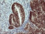 FOXP1 Antibody in Immunohistochemistry (Paraffin) (IHC (P))