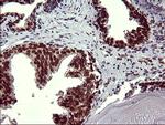 FOXP1 Antibody in Immunohistochemistry (Paraffin) (IHC (P))