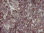 FOXP1 Antibody in Immunohistochemistry (Paraffin) (IHC (P))