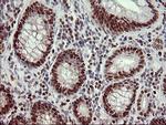 FOXP1 Antibody in Immunohistochemistry (Paraffin) (IHC (P))