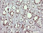 FOXP1 Antibody in Immunohistochemistry (Paraffin) (IHC (P))