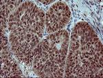 FOXP1 Antibody in Immunohistochemistry (Paraffin) (IHC (P))