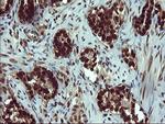 FOXP1 Antibody in Immunohistochemistry (Paraffin) (IHC (P))