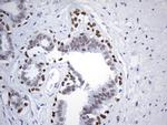 FOXP1 Antibody in Immunohistochemistry (Paraffin) (IHC (P))