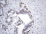 FOXP1 Antibody in Immunohistochemistry (Paraffin) (IHC (P))