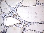 FOXP1 Antibody in Immunohistochemistry (Paraffin) (IHC (P))