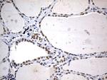 FOXP1 Antibody in Immunohistochemistry (Paraffin) (IHC (P))