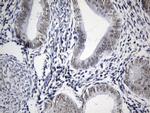 FOXP1 Antibody in Immunohistochemistry (Paraffin) (IHC (P))