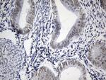 FOXP1 Antibody in Immunohistochemistry (Paraffin) (IHC (P))