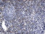 FOXP1 Antibody in Immunohistochemistry (Paraffin) (IHC (P))