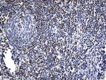 FOXP1 Antibody in Immunohistochemistry (Paraffin) (IHC (P))