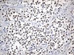 FOXP1 Antibody in Immunohistochemistry (Paraffin) (IHC (P))
