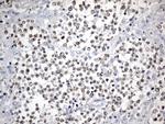 FOXP1 Antibody in Immunohistochemistry (Paraffin) (IHC (P))