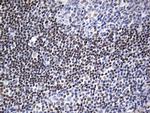 FOXP1 Antibody in Immunohistochemistry (Paraffin) (IHC (P))