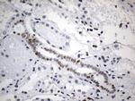 FOXP1 Antibody in Immunohistochemistry (Paraffin) (IHC (P))