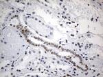 FOXP1 Antibody in Immunohistochemistry (Paraffin) (IHC (P))