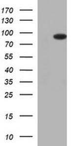 FOXP1 Antibody in Western Blot (WB)