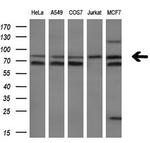 FOXP1 Antibody in Western Blot (WB)