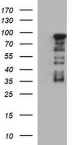 FOXP1 Antibody in Western Blot (WB)