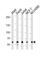FOXP1 Antibody in Western Blot (WB)