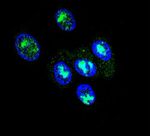 FOXP2 Antibody in Immunocytochemistry (ICC/IF)