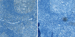 FOXP3 Antibody in Immunohistochemistry (Paraffin) (IHC (P))