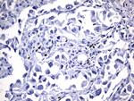 FOXP3 Antibody in Immunohistochemistry (Paraffin) (IHC (P))