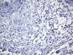 FOXP3 Antibody in Immunohistochemistry (Paraffin) (IHC (P))