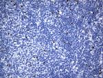 FOXP3 Antibody in Immunohistochemistry (Paraffin) (IHC (P))