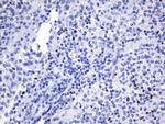 FOXP3 Antibody in Immunohistochemistry (Paraffin) (IHC (P))