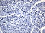 FOXP3 Antibody in Immunohistochemistry (Paraffin) (IHC (P))
