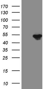 FOXP3 Antibody in Western Blot (WB)